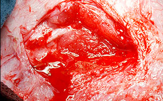 place mrdh on open wound