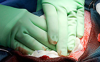 apply compression until bleeding stops