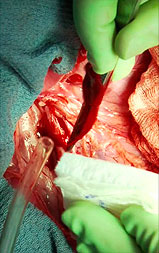 control patient bleeding